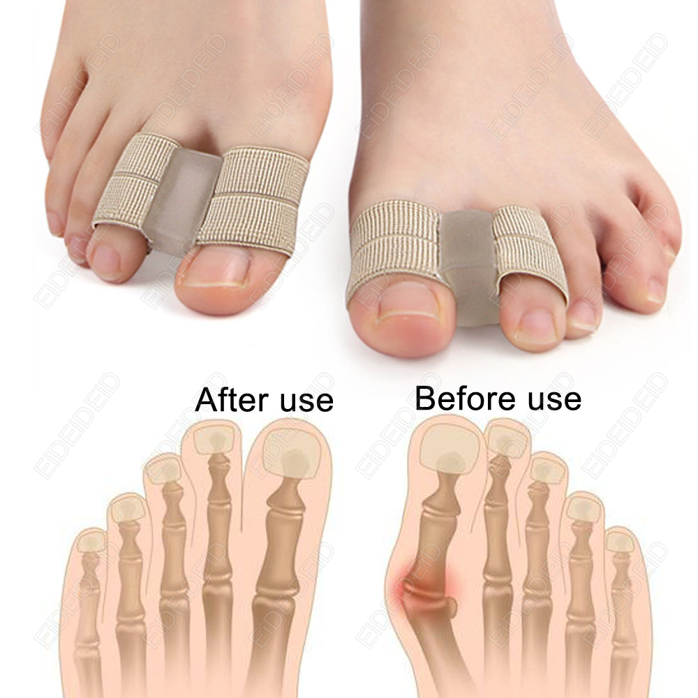 Bunion toe Corrector Orthotics - Women'S Shoes With Bunions recension och pris